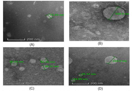 Extracellular membrane vesicles (EMVs) from different serotypes of Streptococcus  pneumoniae under transmission electron microscope (TEM). (A) ATCC 49619 (serotype 19F);  (B) Sample T39 (Serotype 19F); (C) Sample T19 (Serotype 14); (D) Sample T43 (Serotype 6A)