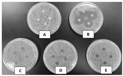 Inhibition zone of M. ptelefolia cream against S. aureus A) MP0 B) Positive control   C) MP2 D) MP4 E) MP6