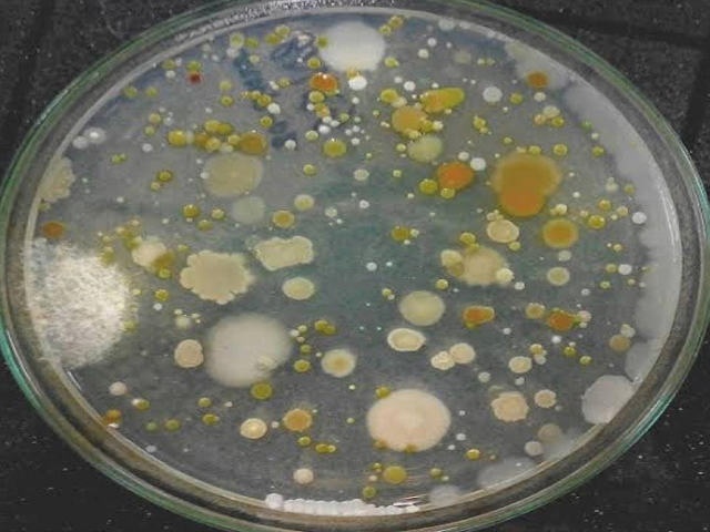 Comparative Analytics of urine sample reported with Urinary tract infection