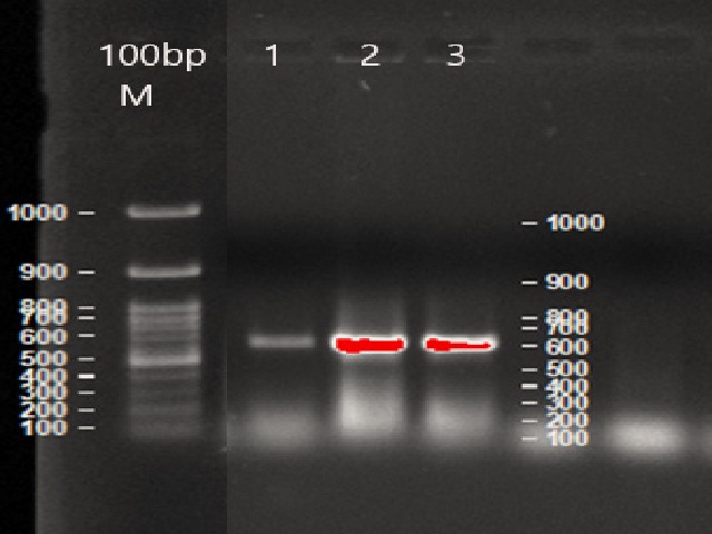 PCR Amplified ITS gene of three samples of G. mbrekobenum.