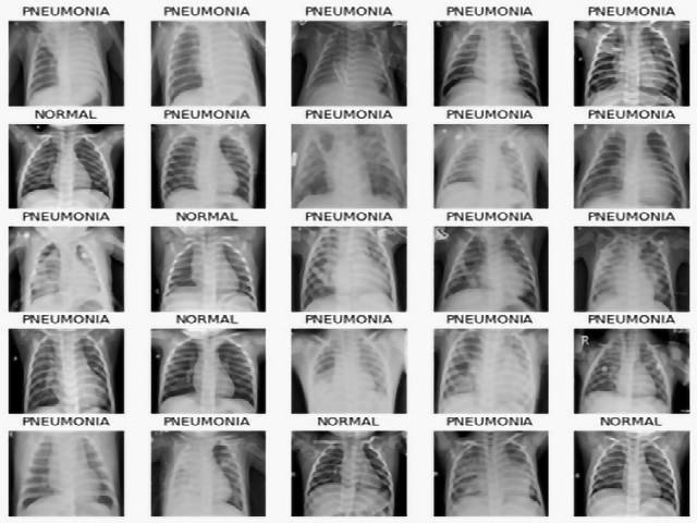 Sample images of two different classes namely Normal and Pneumonia