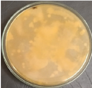 Primary screening on skim milk agar