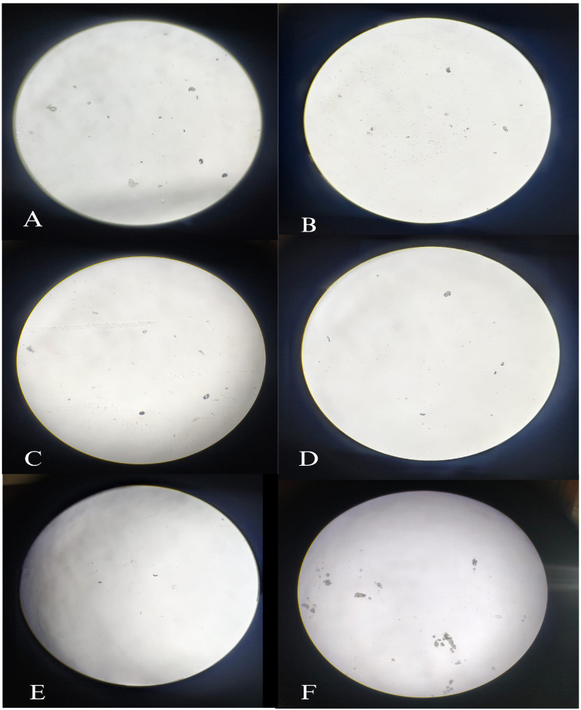 Microscopic analysis of CaOX crystals in the in the presence of extract (A) 50 μg/ml, (B) 100 μg/ml, (C) 200 μg/ml, (D) 400 μg/ml, (E) 800 μg/ml, and (F) absence of extract.