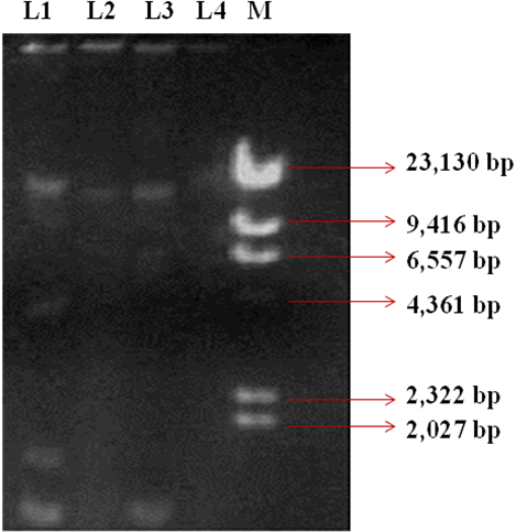 Plasmid Profile of Enterococcus sp