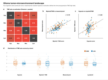 Coordinated myeloid, mesenchymal and hypoxia programmes in the glioma TME. Overview of the major TME-associated transcriptional programmes and their co-activation patterns across the analysed glioma cohorts.