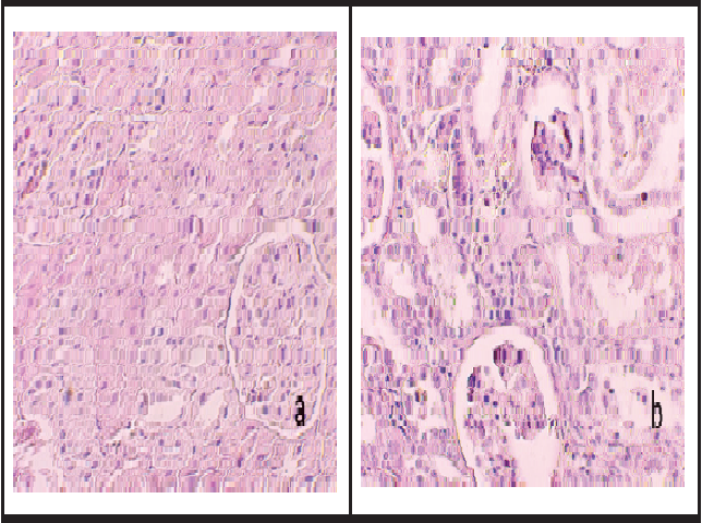 Kidney histopathological changes. (a) Kidney of control group (b) Kidney of sodium fluoride exposed groupab