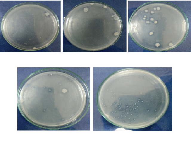 The serially diluted water, soil sample, and direct water samples were placed on