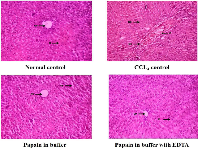  Effect of PN on histological changes in liver